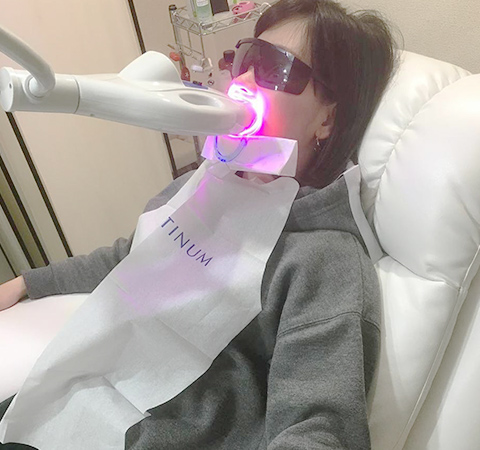 ホワイトニング
