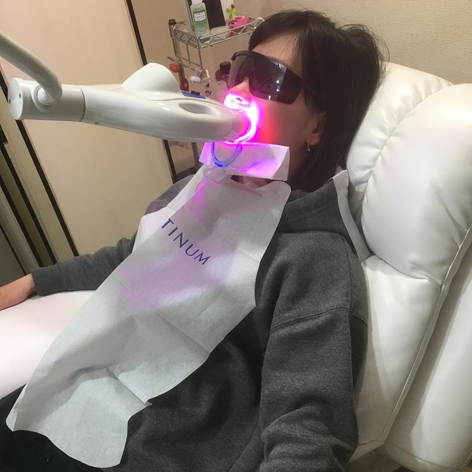 Ma'sのホワイトニング